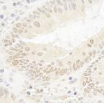 DOT1L Antibody in Immunohistochemistry (Paraffin) (IHC (P))