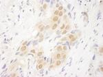 DOT1L Polyclonal Antibody