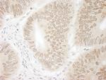 DTL/CDT2 Antibody in Immunohistochemistry (Paraffin) (IHC (P))
