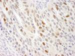 KIFC1 Antibody in Immunohistochemistry (Paraffin) (IHC (P))