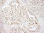 KIFC1 Polyclonal Antibody
