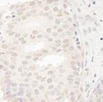 CASC5 Antibody in Immunohistochemistry (Paraffin) (IHC (P))