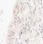 CASC5 Antibody in Immunohistochemistry (Paraffin) (IHC (P))