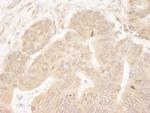 MCAK Antibody in Immunohistochemistry (Paraffin) (IHC (P))