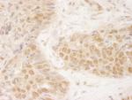 MCAK Antibody in Immunohistochemistry (Paraffin) (IHC (P))