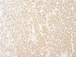 MCAK Antibody in Immunohistochemistry (Paraffin) (IHC (P))