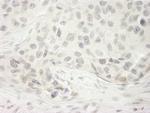 DHX33 Antibody in Immunohistochemistry (Paraffin) (IHC (P))