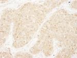 ERK1 Antibody in Immunohistochemistry (Paraffin) (IHC (P))