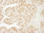 USP15 Polyclonal Antibody