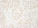 USP37 Antibody in Immunohistochemistry (Paraffin) (IHC (P))