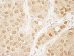 AKT1 Antibody in Immunohistochemistry (Paraffin) (IHC (P))