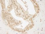 AKT1 Antibody in Immunohistochemistry (Paraffin) (IHC (P))