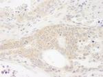 DDX19 Antibody in Immunohistochemistry (Paraffin) (IHC (P))