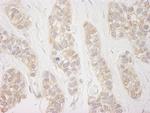DDX19 Polyclonal Antibody