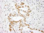 RALY Antibody in Immunohistochemistry (Paraffin) (IHC (P))