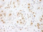 hPrp3p Polyclonal Antibody