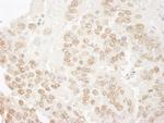 hPrp3p Antibody in Immunohistochemistry (Paraffin) (IHC (P))