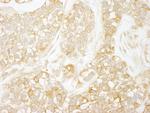 RelA Antibody in Immunohistochemistry (Paraffin) (IHC (P))