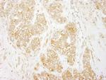 RelA Antibody in Immunohistochemistry (Paraffin) (IHC (P))