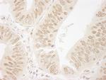 FALZ/BPTF Antibody in Immunohistochemistry (Paraffin) (IHC (P))
