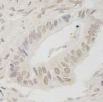 ANKRD28/PITK Polyclonal Antibody