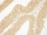 CTNND1 Antibody in Immunohistochemistry (Paraffin) (IHC (P))