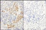 Phospho-RelA (Ser536) Antibody in Immunohistochemistry (Paraffin) (IHC (P))