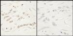 Phospho-RelA (Ser468) Antibody in Immunohistochemistry (Paraffin) (IHC (P))