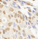 JHDM1A Antibody in Immunohistochemistry (Paraffin) (IHC (P))