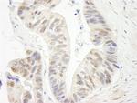 ERCC5/XPG Polyclonal Antibody