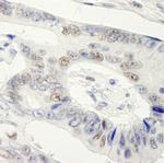 Symplekin Antibody in Immunohistochemistry (Paraffin) (IHC (P))