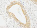 MAP4K4/HGK Polyclonal Antibody