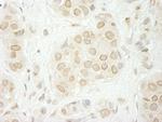 LAP1B Polyclonal Antibody