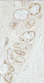 LAP1B Antibody in Immunohistochemistry (Paraffin) (IHC (P))