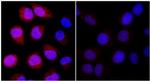 REDD1 Antibody in Immunocytochemistry (ICC/IF)