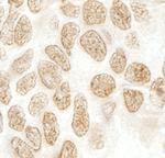 SRcyp Antibody in Immunohistochemistry (Paraffin) (IHC (P))