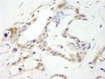 CPSF100 Polyclonal Antibody