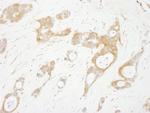 OSR1 Polyclonal Antibody