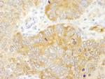 PABP4 Antibody in Immunohistochemistry (Paraffin) (IHC (P))