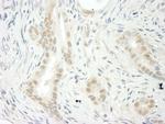 THOC5 Polyclonal Antibody