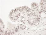TORC2 Antibody in Immunohistochemistry (Paraffin) (IHC (P))