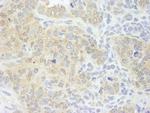 eIF4G1/eIF4GI Antibody in Immunohistochemistry (Paraffin) (IHC (P))