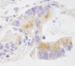 EML4 Polyclonal Antibody