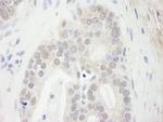 Menin Antibody in Immunohistochemistry (Paraffin) (IHC (P))