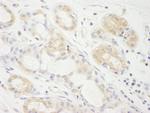 eIF2A Polyclonal Antibody
