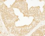 PDZ-RhoGEF Antibody in Immunohistochemistry (Paraffin) (IHC (P))