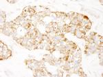 Prohibitin Antibody in Immunohistochemistry (Paraffin) (IHC (P))