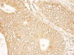RanGAP1 Polyclonal Antibody
