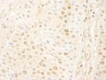 Cyclin C Antibody in Immunohistochemistry (Paraffin) (IHC (P))