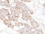 PDZ-GEF1 Polyclonal Antibody